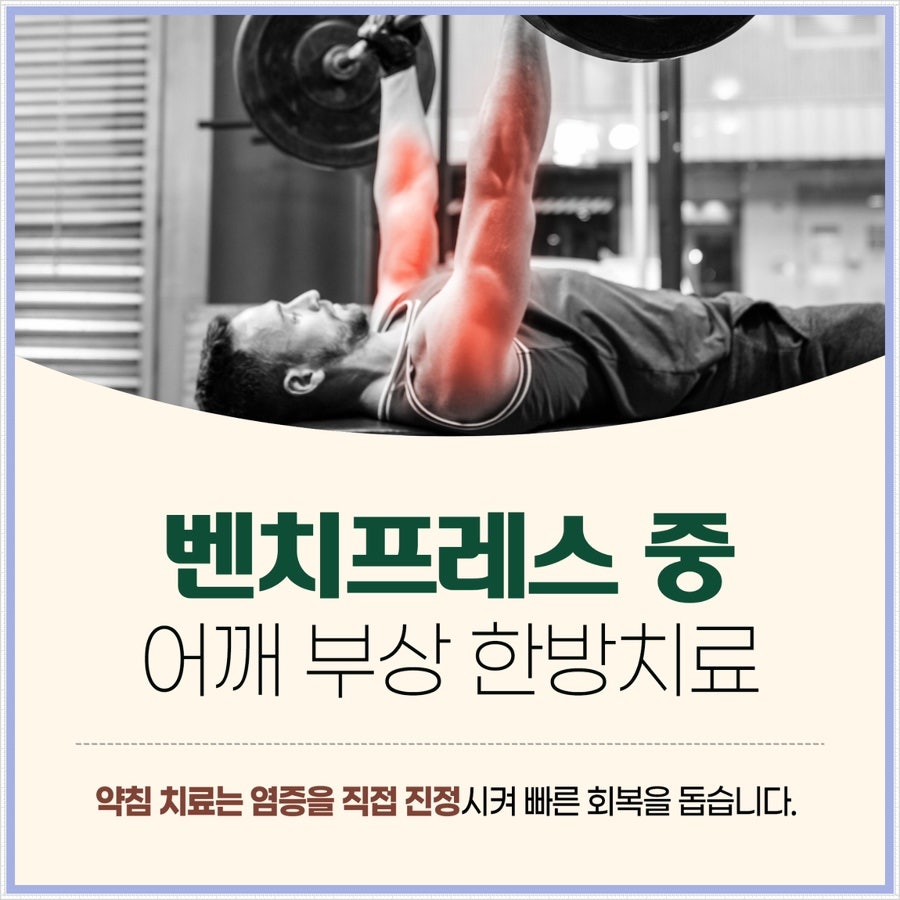 벤치프레스 중 어깨 부상 제주시한의원