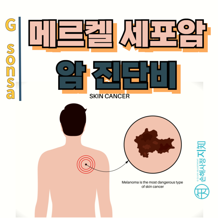  메르켈세포암, 단순 피부암 아닌 고악성암! 일반암진단비 전액 받을 수 있을까?