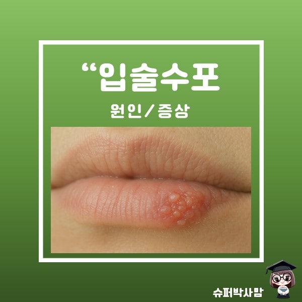 입술 주변 수포 원인 증상