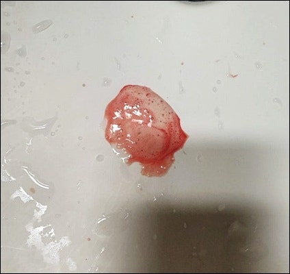 잇치 치약 가격 효과 사용법
