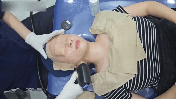 강남역 티타늄, 통증 없다는 말 믿어도 될까? 실제 시술 과정 공개
