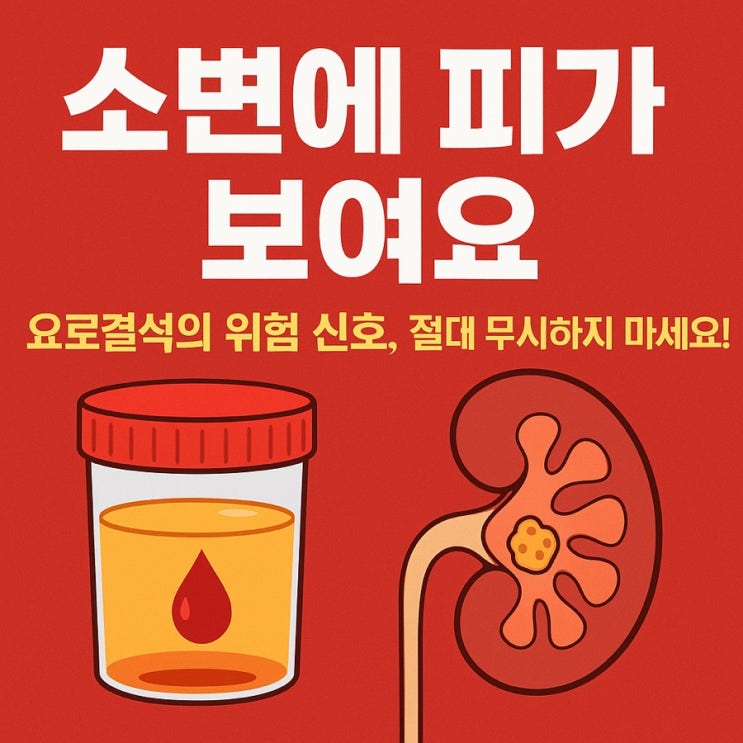  소변에 피가 보인다면️ 혈뇨로 의심되는 요로결석 신호