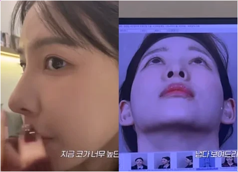  환승연애2 이나연 돌연 코 복원 재수술 결심! 팬들 반응은?