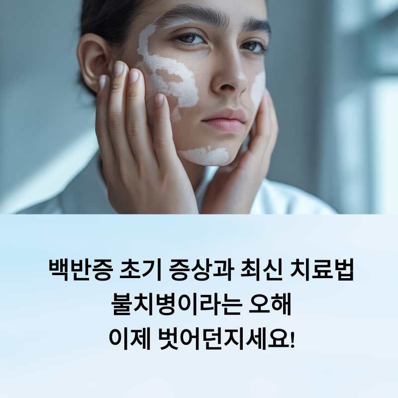 백반증 초기 증상과 최신 치료법: 불치병이라는 오해, 이제 벗어던지세요!