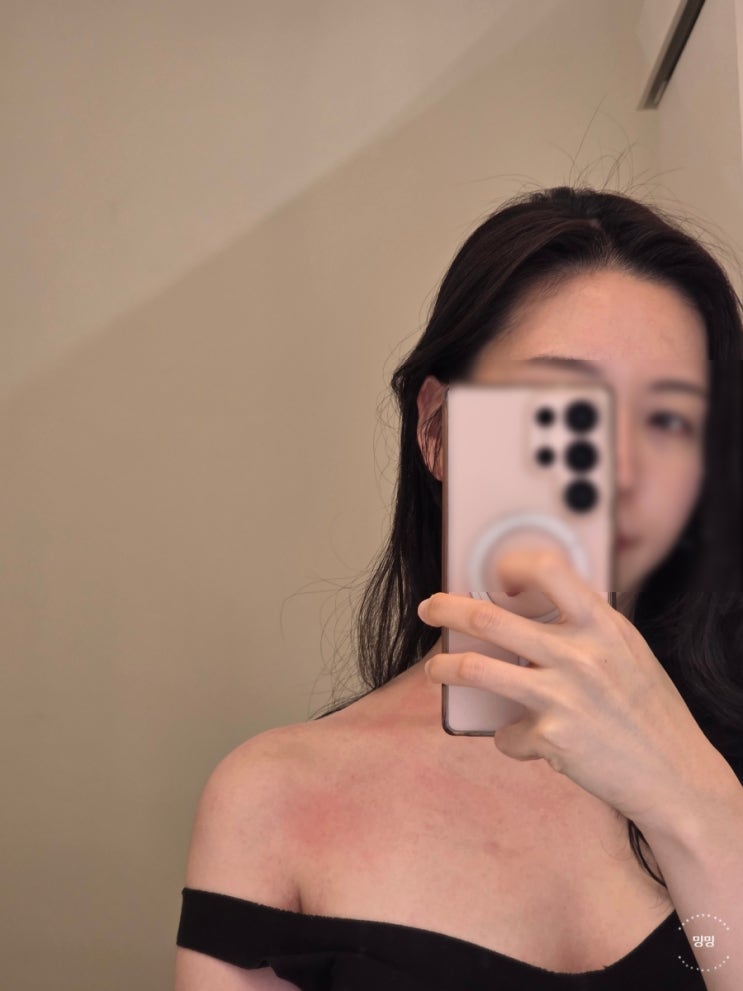  당산 피부관리 비오르 에스테틱 라운드숄더 케어