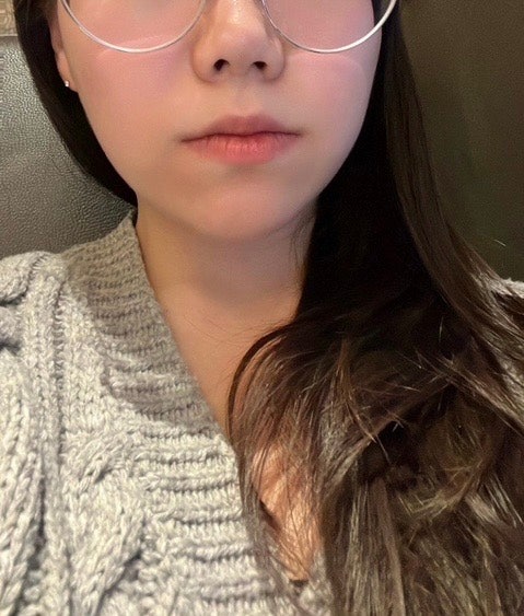  코조각주사+콧볼보톡스 내돈내산 후기 | 서울 성수역 피부과 의원