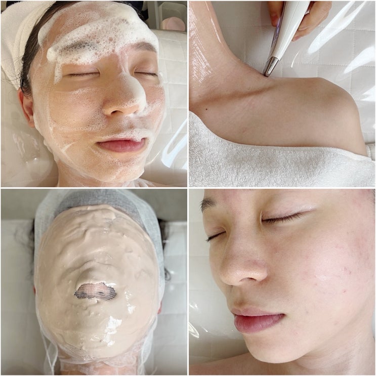  서울대입구 피부관리 더앤에스테틱 트러블관리 여드름관리