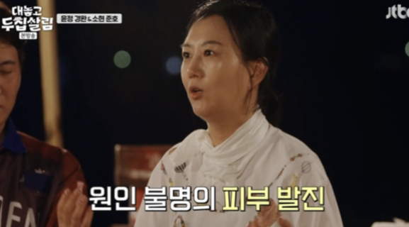   장윤정, 10개월째 원인불명 피부질환 고백…도경완 “불쌍해졌다” (‘두집살림’)