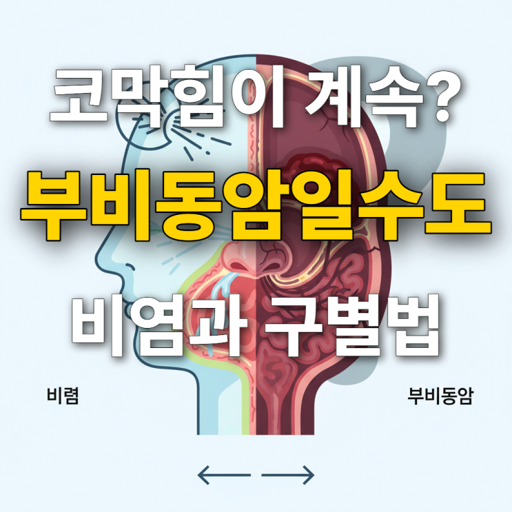  부비동암 증상 명확한 정보와 비염과의 차이점