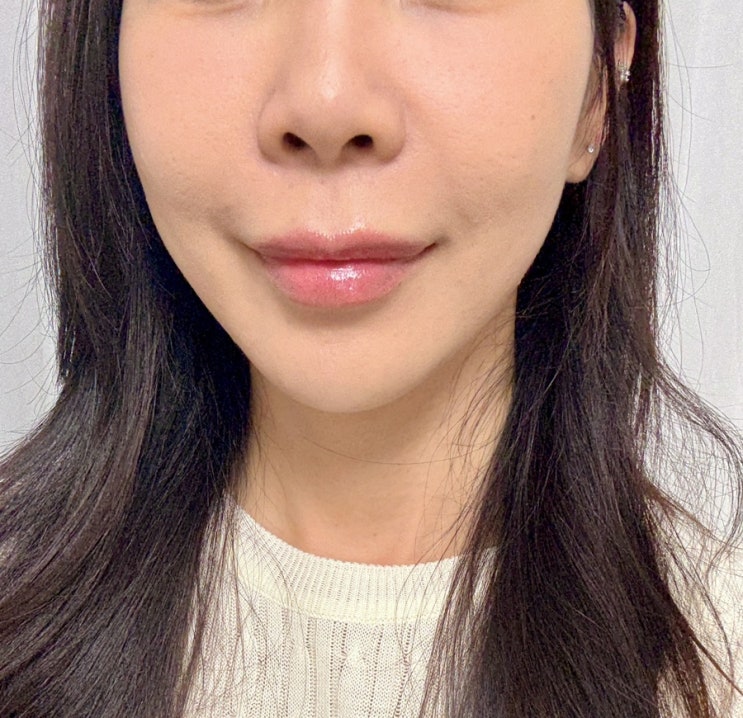 신논현피부과 온다리프팅 6만줄 내돈내산 후기 언니가알려줄게