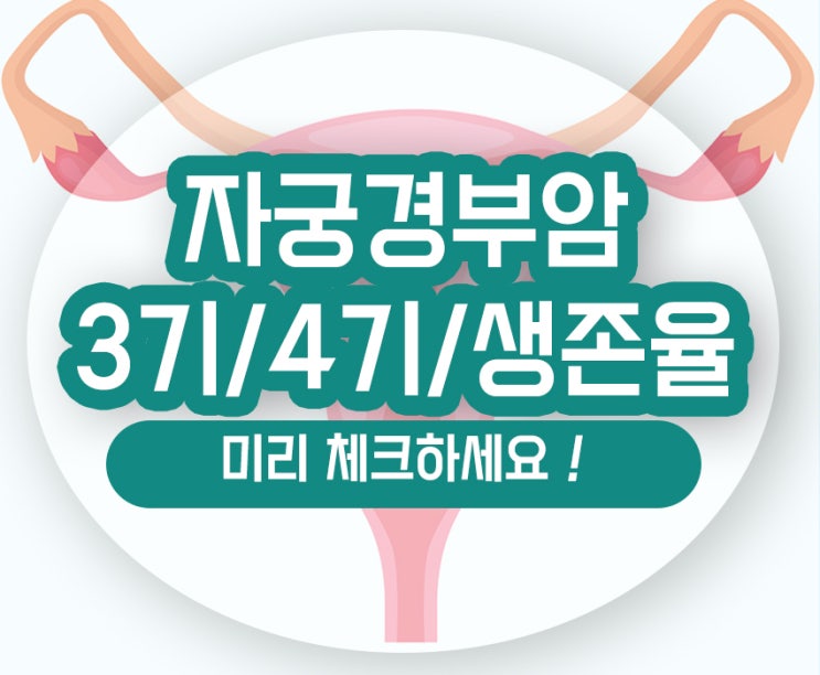  자궁경부암 3기 4기 생존율 항암 예후 알아보기