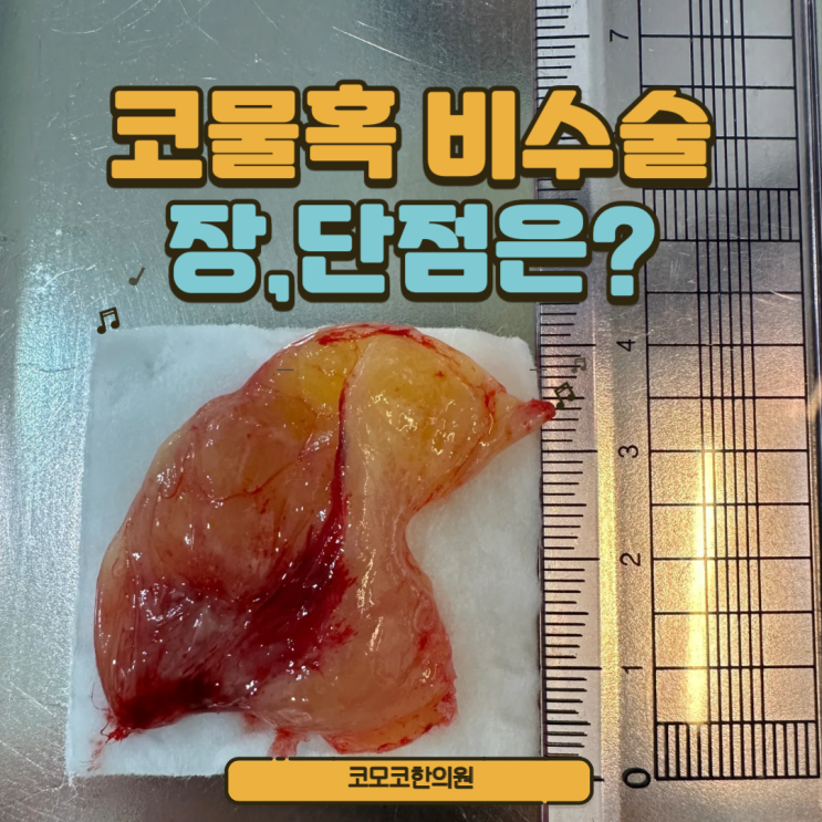  코물혹 한의원에서 제거 가능. 논문도 나왔습니다