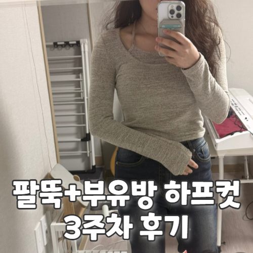  신사 팔뚝지방분해주사비용 3주차 경과 및 부작용 내돈내산 후기