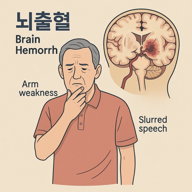 뇌출혈 전조증상 테스트, 반드시 알아야 하는 이유
