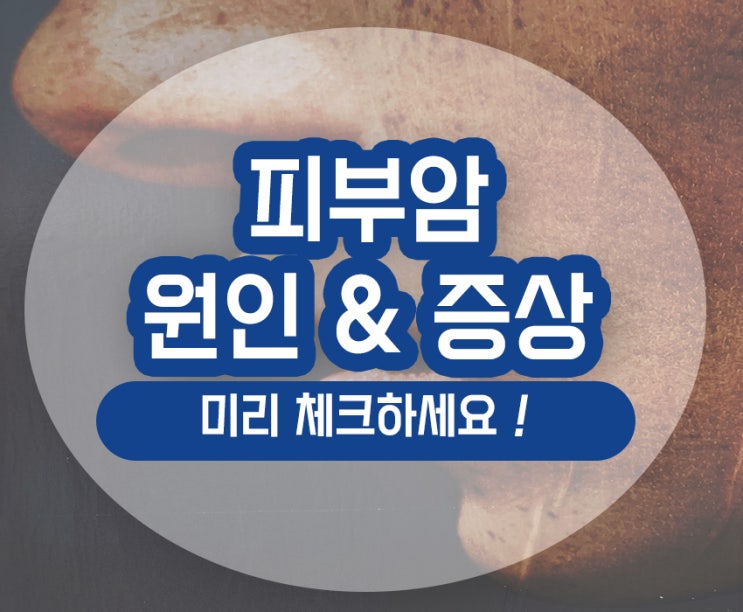  피부암 초기증상 원인 점특징 구분