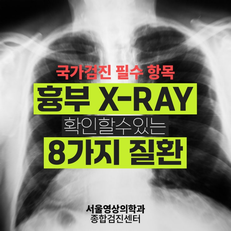  경기광주 국가검진 필수 항목, 흉부 엑스레이 검사로 발견하는 8가지 질환
