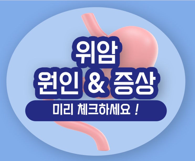  위암 초기증상 원인 설사 속쓰림 소화불량 상복부 통증 식습관 관리