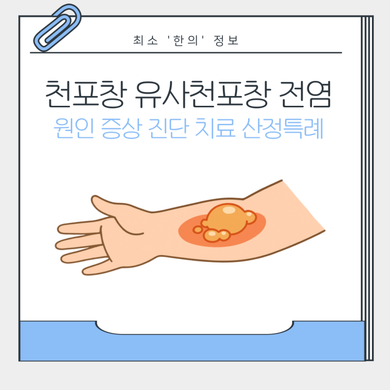 유사 천포창 전염 심상천포창 산정특례 치료 증상 약