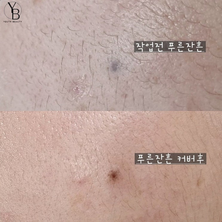  광주미인점 제일 자연스러운 유스뷰티