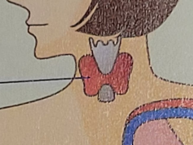 갑상선암 환자 선물 - 갑상선암 수술 입원 준비물 - 입원기간 보호자