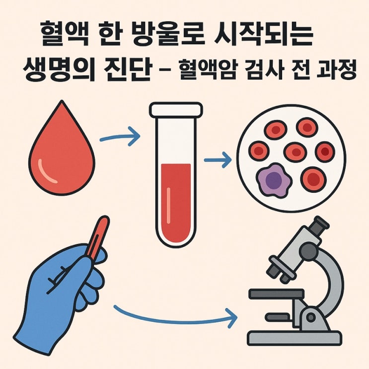  혈액암 진단 과정 완벽 정리 – 혈액검사부터 골수검사까지