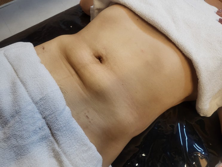  복부 지흡 바본, 단단했던 뱃살이 부드럽게 풀리는 회복 전후