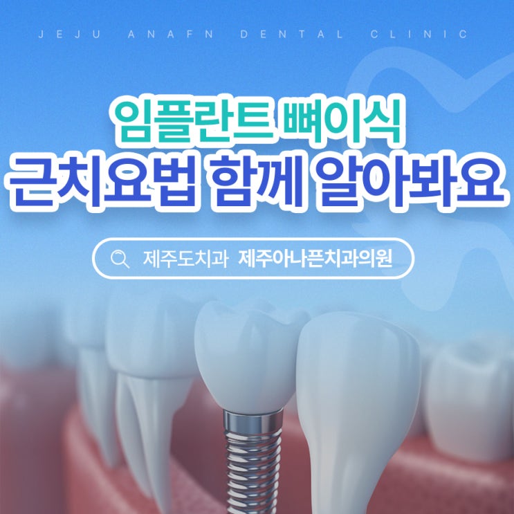  제주도임플란트추천 뼈이식을 권장하는 이유는
