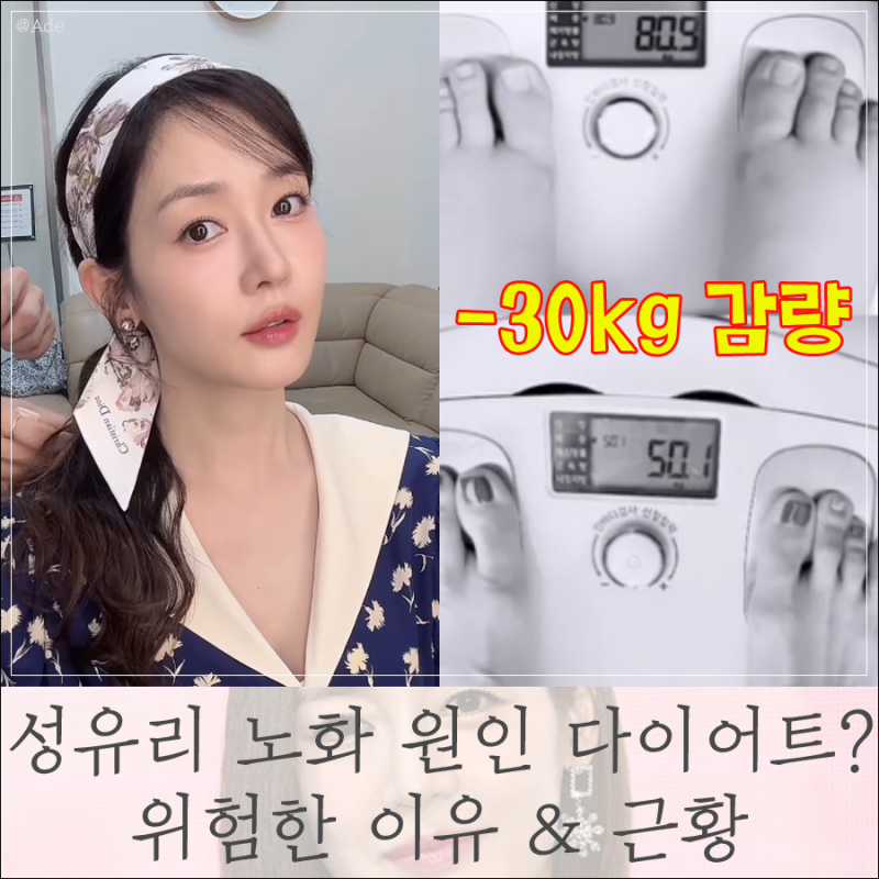 성유리 노화 논란, 원인이 30kg 감량 다이어트? 위험한 이유 & 근황