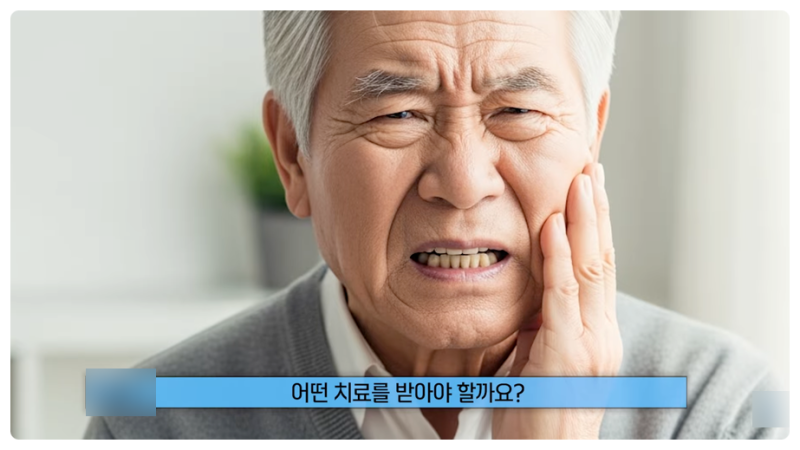 풀아치 임플란트 비용? 최소 100만 원 아끼는 방법