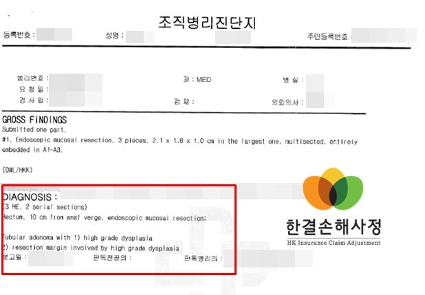 질병코드 D126 진단비 보상은?