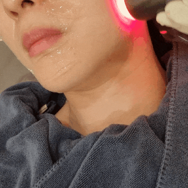  방배동피부과 중안부리프팅 타이탄리프팅 효과 후기