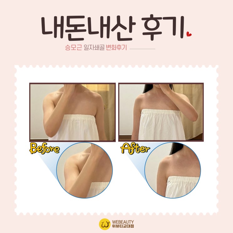  옷걸이형 어깨 승모근이 문제가 아니였어요! [위뷰티교대점 내돈내산 관리후기]