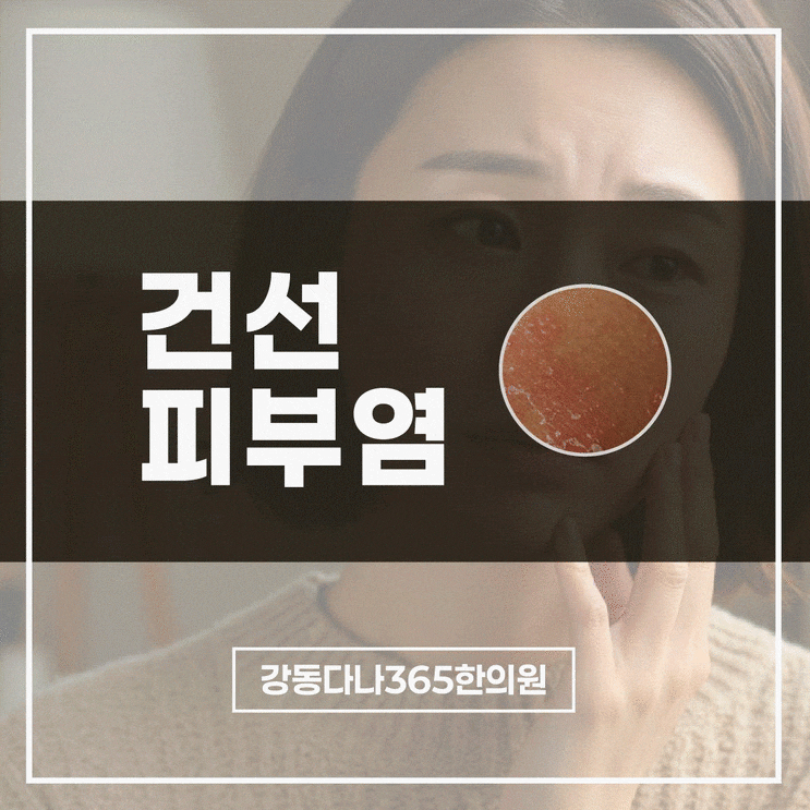  길동역피부질환, 환절기 건선피부 체질 맞춤 관리법