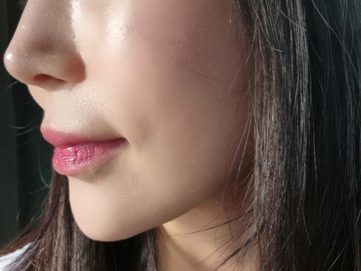  선릉역피부과 줄기세포 스킨부스터 2회차 찐후기