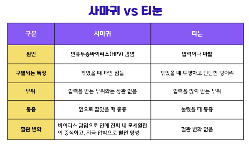 사마귀와 티눈의 보상 여부에 대해 알아보겠습니다.