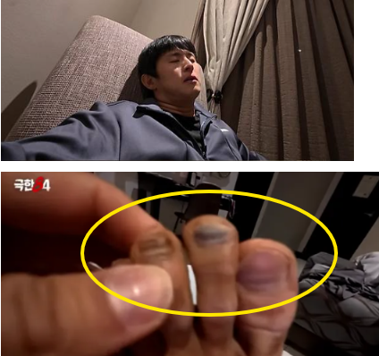 기안84, 7시간 마라톤 직후 모습 보니..시퍼렇게 멍든 발가락 [극한84]