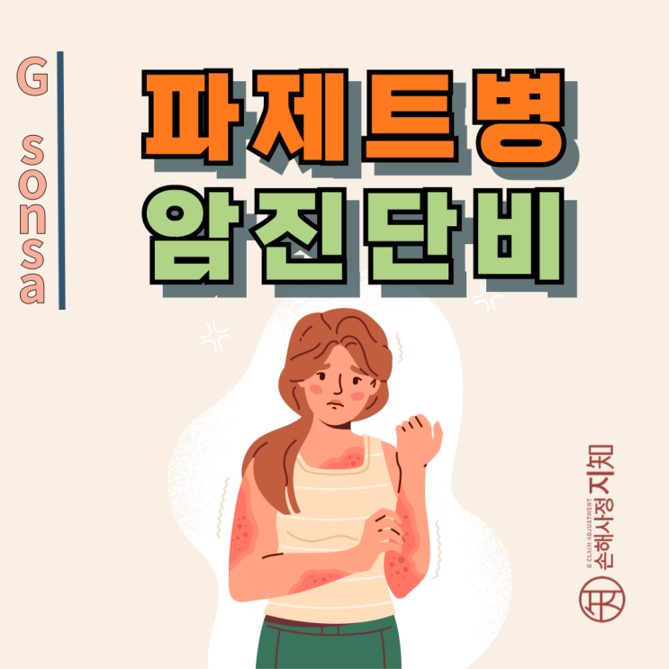  파제트병 원인 – 암 생기는 이유와 보험금 못 받는 이유