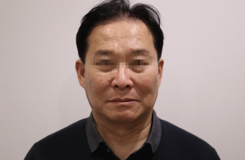 부산진구한의원, 안면마비 후유증에 대해