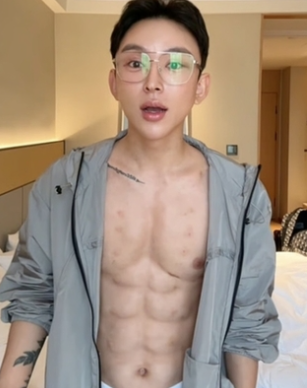   8억 쓴 청년의 8팩 복근… 히알루론산으로 만든 ‘가짜 근육’?
