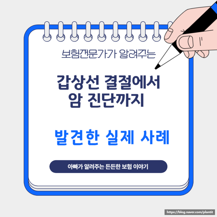  갑상선 결절에서 암 진단까지 발견한 실제 사례