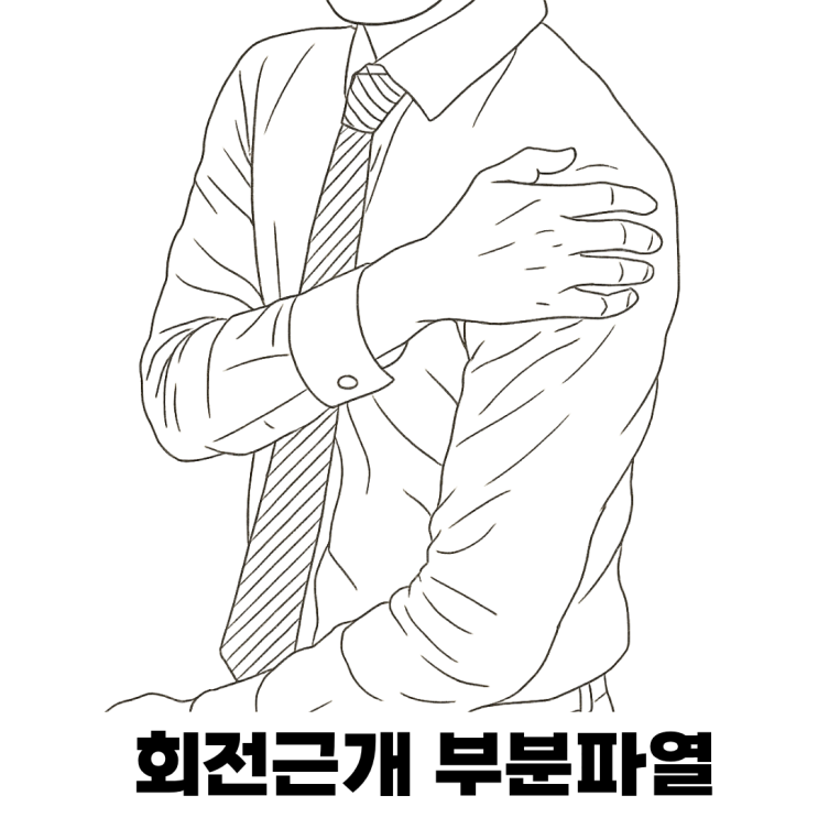  수술 없이도 가능한 회전근개 부분파열 치료, 실제 증례로 살펴보세요