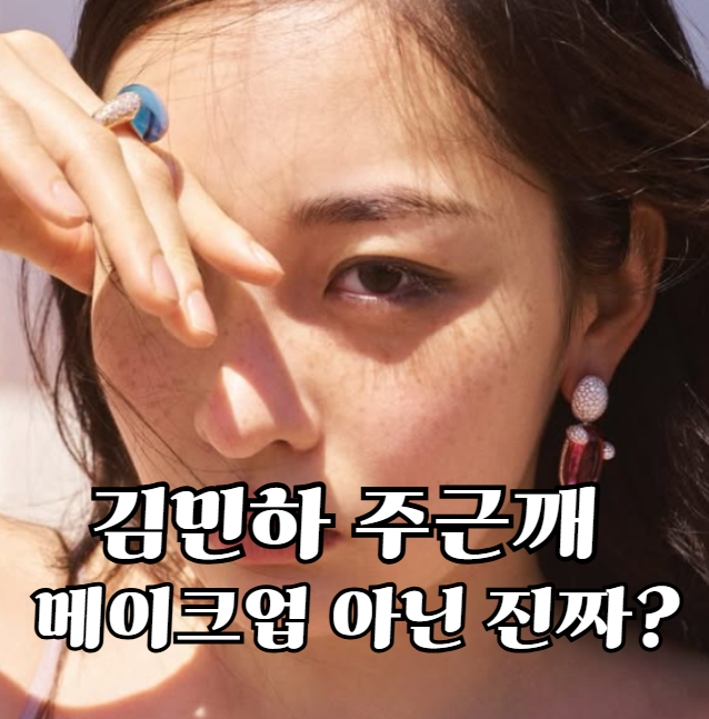 김민하 주근깨, 메이크업 아닌 진짜? 기미와 헷갈리면 안 되는 이유