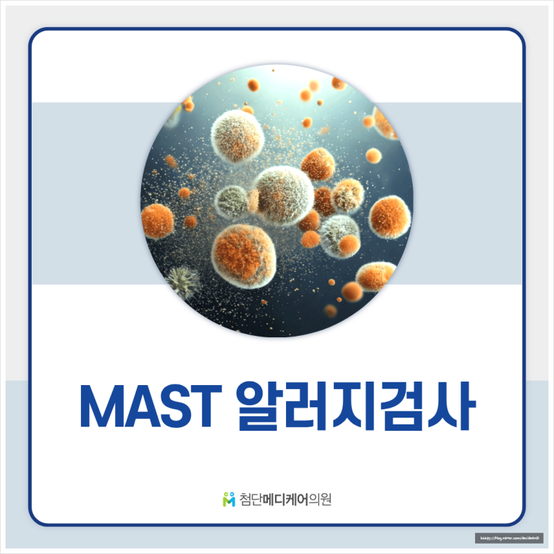 광산구 건강검진에서 알려드리는 MAST 알레르기 검사의 중요성