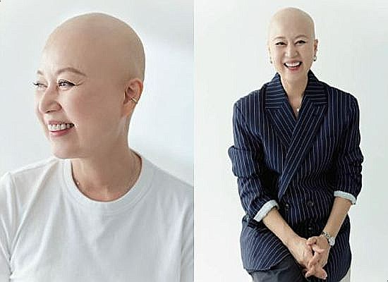 박미선 <b>유방암</b> 투병 민머리 공개에 <b>조세호</b>가 <b>사과</b>한 이유?!... 