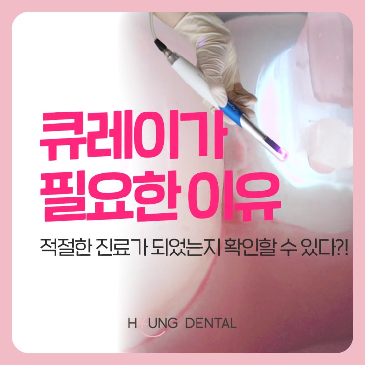  매교역 치과에서 큐레이 장비를 사용하는 이유