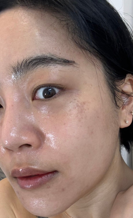  [서울 동대문] 장안동피부관리 ‘가꾸다,미 왁싱&스킨바디’에서 물방울 리프팅 관리받고 왔어요