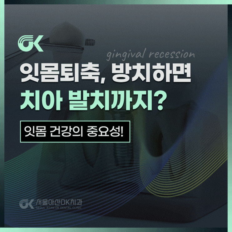  강일역치과, 잇몸퇴축 방치하면 치아발치까지?