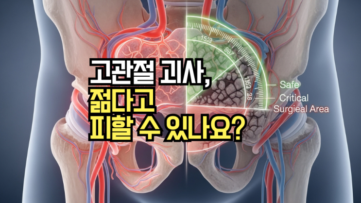  대퇴골두 무혈성 괴사, 수술 꼭 해야 할까요? 핵심 원인(혈액순환 장애)과 수술 피하는 '괴사 각도' 판단 기준