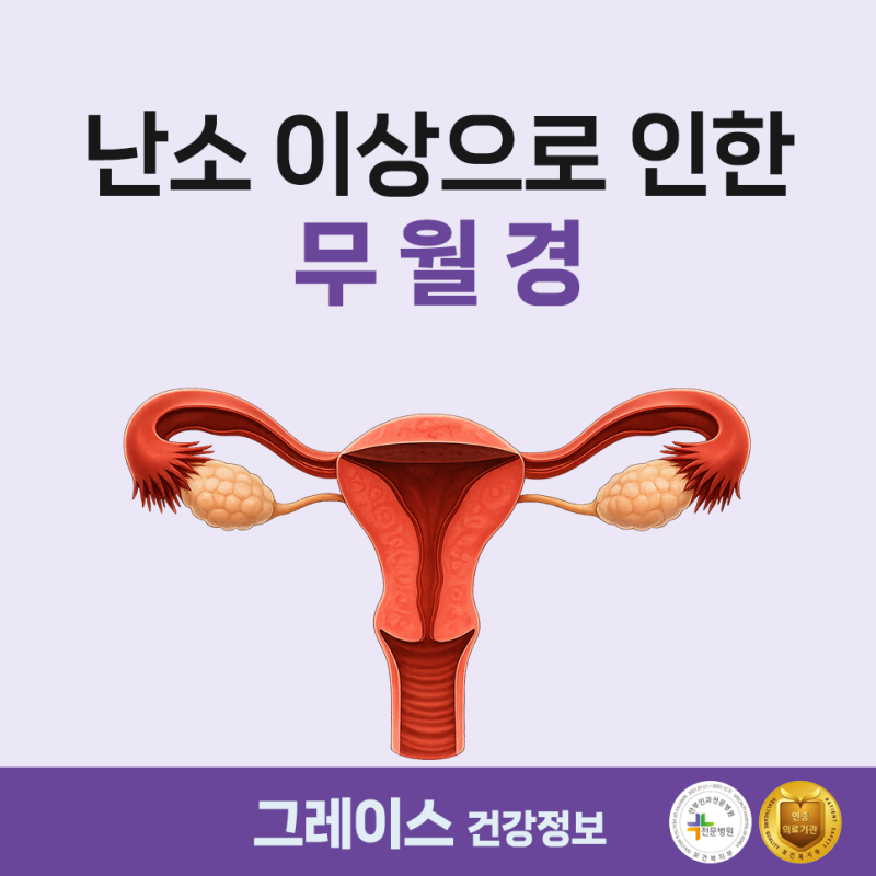 난소의 이상으로 인한 무월경
