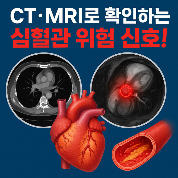  심혈관 상태, CT·MRI로 이렇게 정확하게 확인합니다!